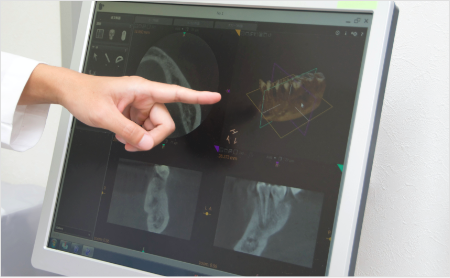 歯科用CT